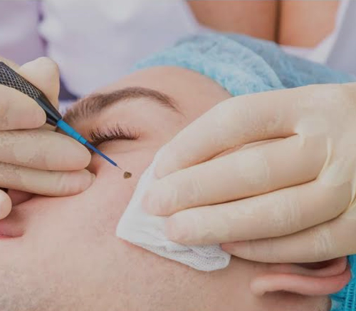 doctors procedure img6